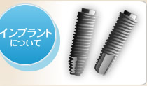 インプラントについて