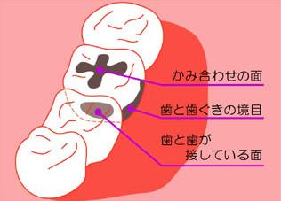 写真1